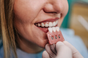 Crowns vs. Veneers: A South Indy Dentist's Honest Guide to Choosing the Right Fix