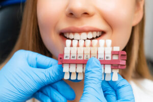 Porcelain Veneers for Franklin and Center Grove Patients: What to Expect at a South Indy Practice
